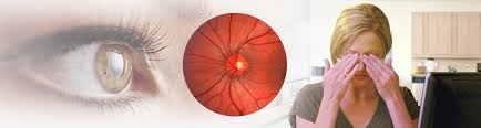 #Ficadica: Glaucoma... O que é? Quais são os sintomas?