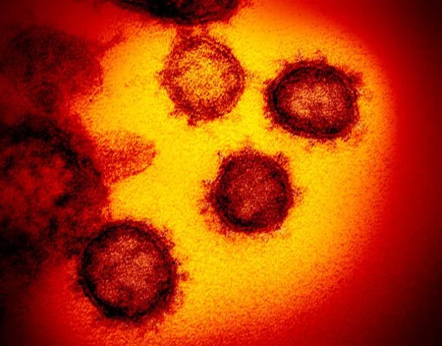 Coronavírus é confirmado em SP e em análise em 3 estados